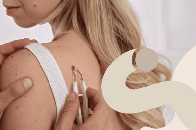 Guida completa alla mappatura dei nei: tutto ciò che devi sapere