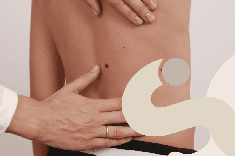 Nei pericolosi: come riconoscerli e quando consultare un medico